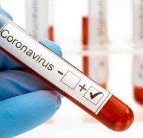 थप ८ हजार ६०७ जनामा कोरोना पुष्टि, निको हुने दर ७५.४ प्रतिशत